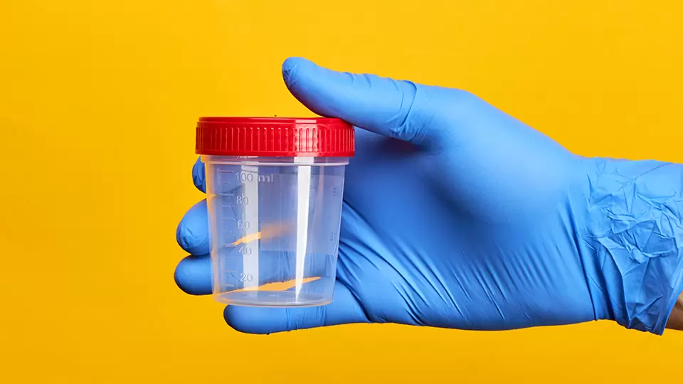 Blå plasthandske håller i testkopp